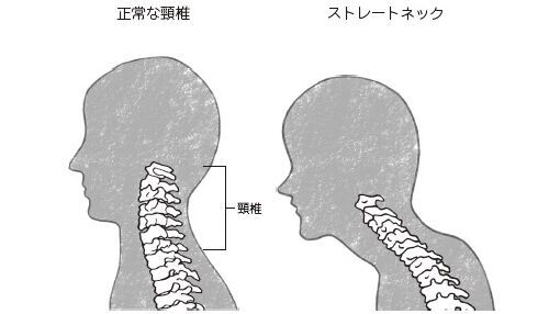 1日20回「足上げ」するだけ！スマホ不調を防ぐ超簡単なポーズ