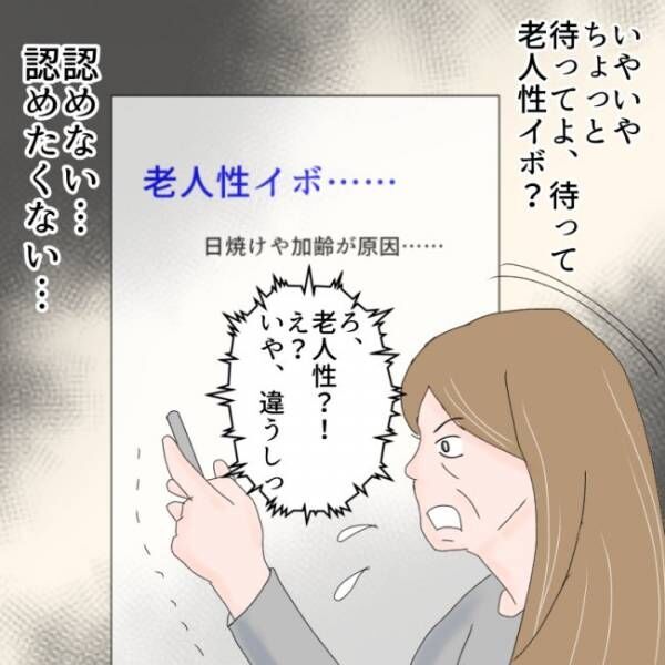 「いつからある…？」自分の一部と化していたイボがかゆくなり…＃ほくろ除去編 ＃熟女系 40