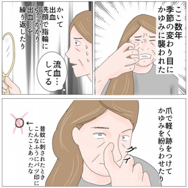 「いつからある…？」自分の一部と化していたイボがかゆくなり…＃ほくろ除去編 ＃熟女系 40