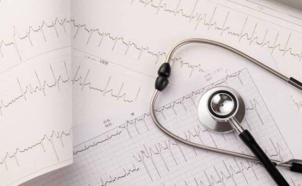 聴診器と心電図のイメージ