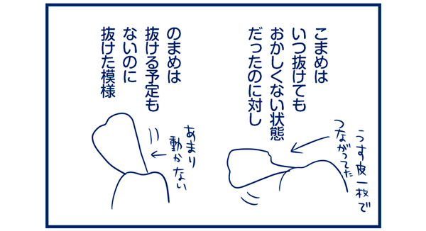 肉を食べると歯が抜ける双子間のジンクス【双子を授かっちゃいましたヨ☆ 第35話】