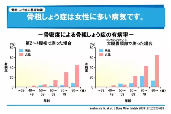 女性に急増「骨粗鬆症」を改善する新プログラムが始動