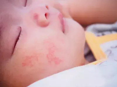 乳幼児の予防スキンケアに最適！ベビースキンケアブランド「ママフィ」誕生