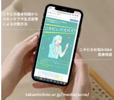 【医師による正しい知識】ニキビ情報総合メディア『ニキビにバイバイ！』2022年9月開設