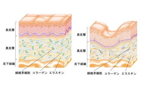 肌の屋台骨“真皮”に着目!!  新生オバジ「ダーマエラスティックX」シリーズ誕生