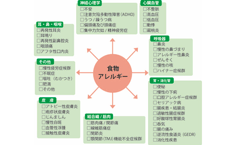 その不調、実はアレルギーが原因かも？　もっと健康な生活を目指すあなたにオススメ