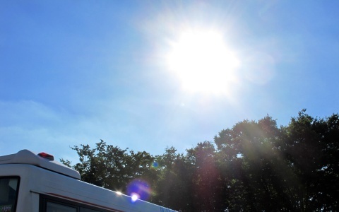 夏の紫外線をシミに変えない　日焼け後のケア