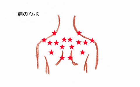 あなたはどのタイプ？ つら〜い肩こりを解消する方法