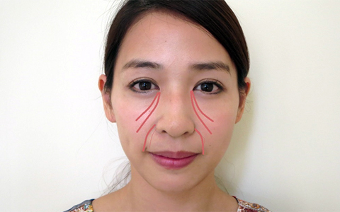 「ほうれい線」と「ゴルゴ線」老けてみられるふたつの線、放っておいたら損だらけ!?