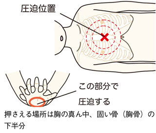 大切な人のために知っておきたい、誰でもカンタンに使えるAEDのこと