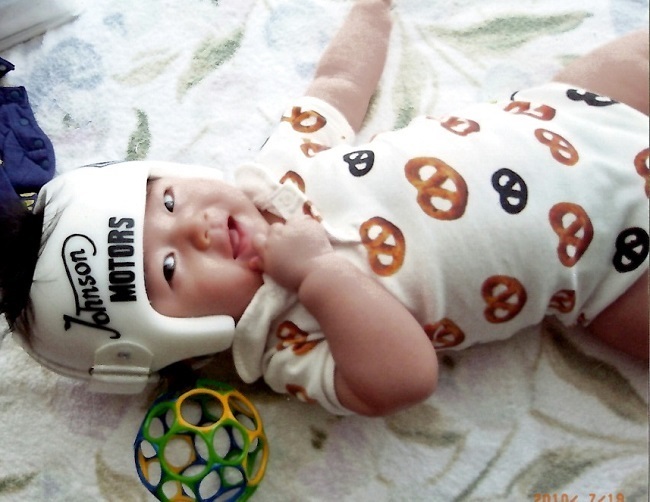 大渕弁護士がブログに綴った「頭蓋形状誘導ヘルメット」で治療した体験記