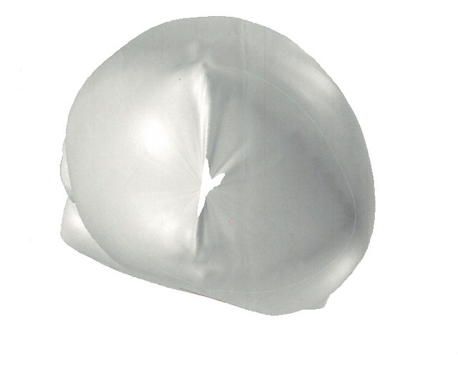 大渕弁護士がブログに綴った「頭蓋形状誘導ヘルメット」で治療した体験記