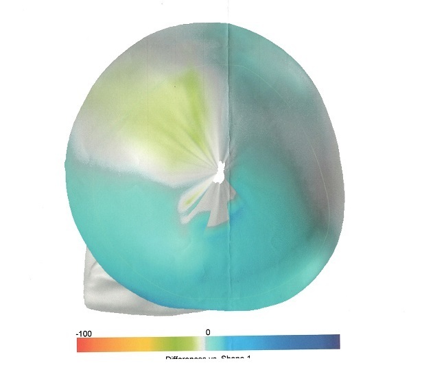 大渕弁護士がブログに綴った「頭蓋形状誘導ヘルメット」で治療した体験記
