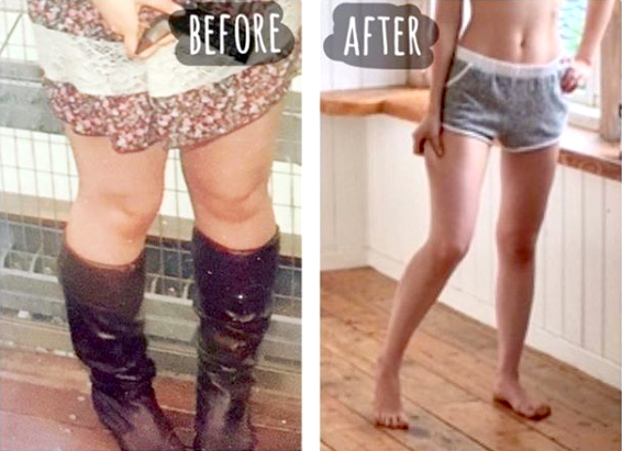 産後に太くなった脚はもみほぐせ！ ダイエット美容家、本島彩帆里の「美脚メソッド」