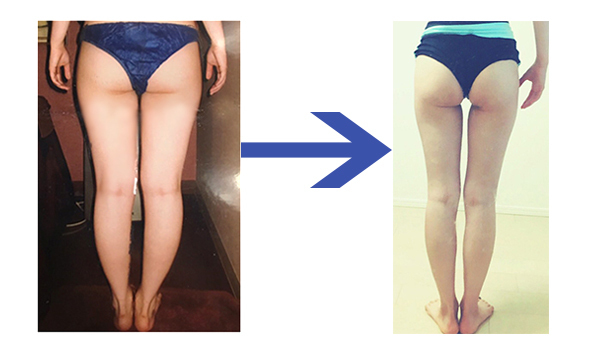 産後の“垂れ尻”を解消！ 「お尻」をほぐして美脚&脚長を手に入れる