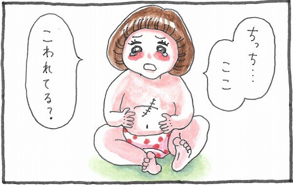 壊れてる 自分の手術跡をみた娘が涙に ママが誇りに思ったこととは 泣いて 笑って グラハムコソダテ Vol 8 ウーマンエキサイト 1 3