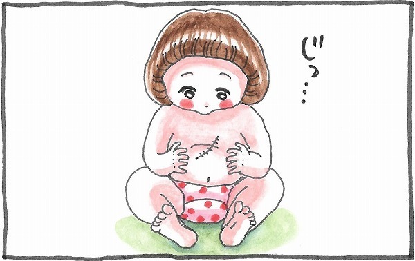 「壊れてる」自分の手術跡をみた娘が涙に…。ママが誇りに思ったこととは【泣いて！ 笑って！ グラハムコソダテ  Vol.8】