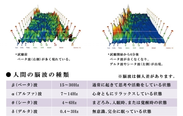 赤ちゃんの寝かしつけに音楽？　プロに聞いた「1/f ゆらぎ」の本当のところ