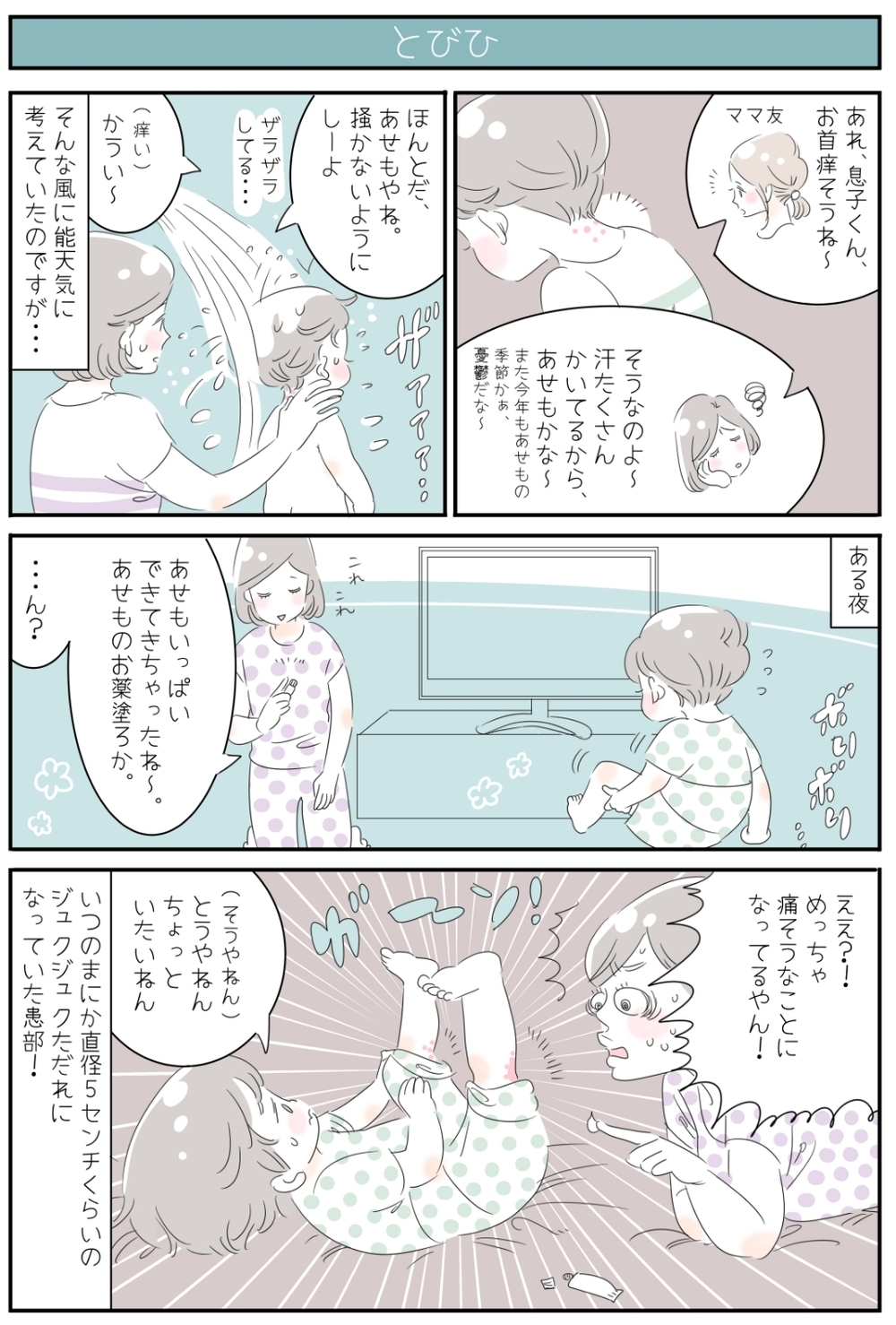 子どもの「とびひ」は「あせも」から？ 夏のお肌は要注意！【子育ては毎日がたからもの☆ 第25話】