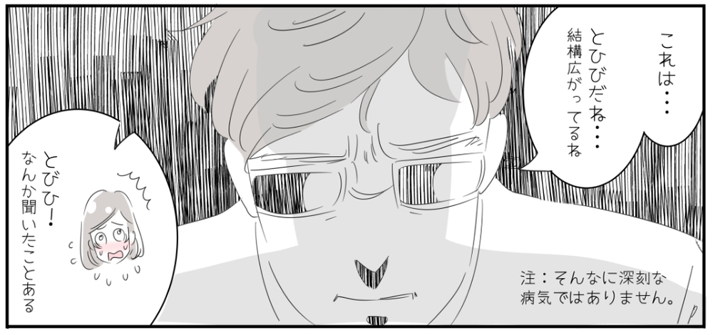 子どもの「とびひ」は「あせも」から？ 夏のお肌は要注意！【子育ては毎日がたからもの☆ 第25話】