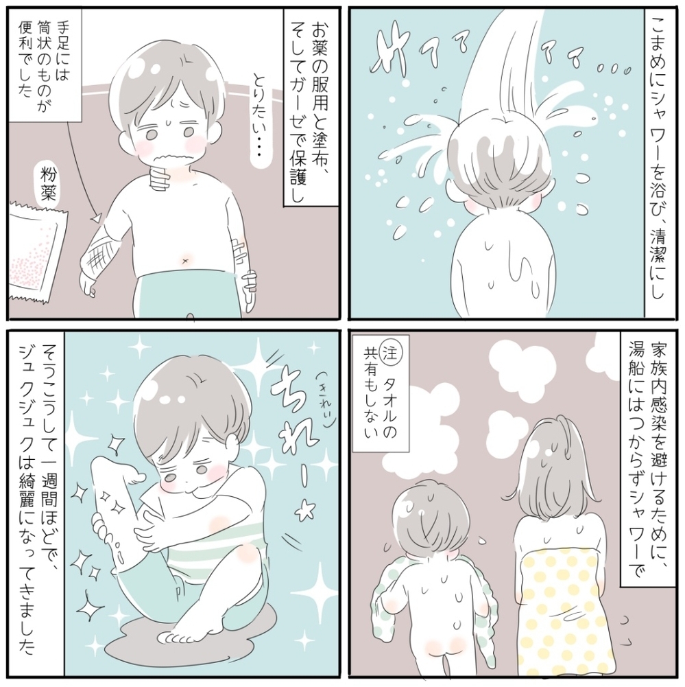 子どもの「とびひ」は「あせも」から？ 夏のお肌は要注意！【子育ては毎日がたからもの☆ 第25話】