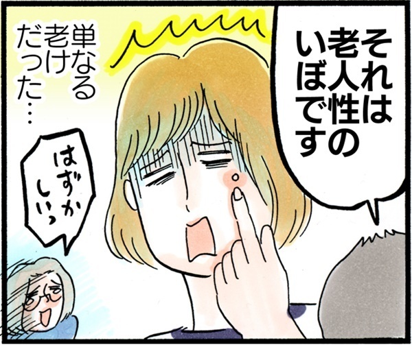 水いぼは大人にもうつるの？ 病院に行ったら…【荻並トシコのどーでもいいけど共感されたい！ 第3話】