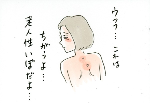 水いぼは大人にもうつるの？ 病院に行ったら…【荻並トシコのどーでもいいけど共感されたい！ 第3話】