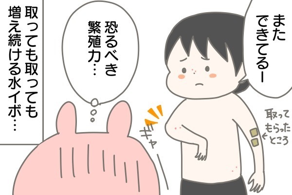 水いぼパニック！ 増えつづける“ポチ”を消滅させるには【産後太りこじらせ母日記 第3話】