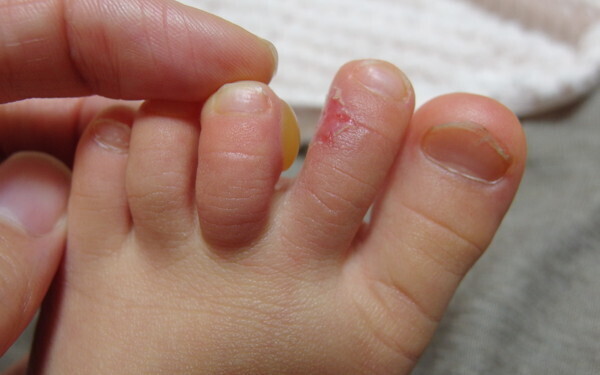 子ども靴のプロに聞いた「正しいはき方・選び方」「サイズの目安」「買い替え時」