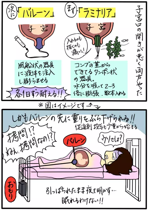 出産で痛いのは陣痛だけではない…！　4回の出産を比べてみた