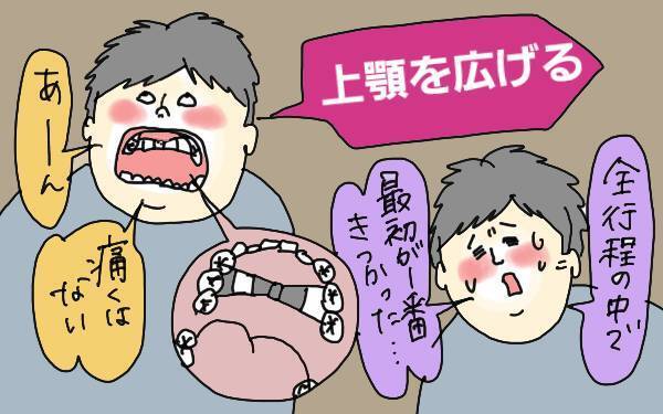 子どもの歯科矯正に40万!? 1年間頑張った成果のほどは？【コソダテフルな毎日 第89話】