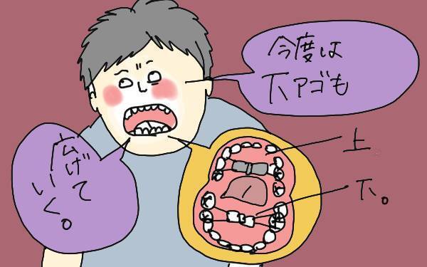 子どもの歯科矯正に40万!? 1年間頑張った成果のほどは？【コソダテフルな毎日 第89話】