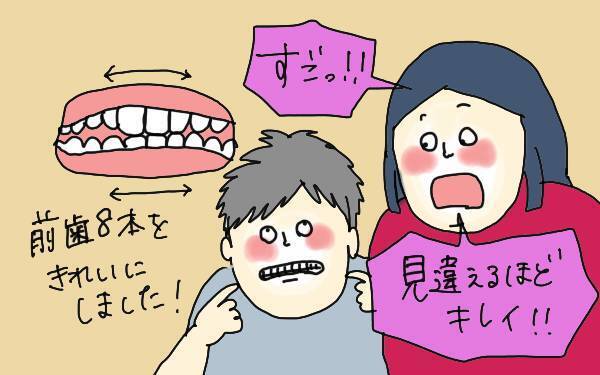 子どもの歯科矯正に40万!? 1年間頑張った成果のほどは？【コソダテフルな毎日 第89話】