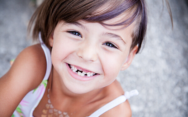 子どもの歯科矯正 費用 方法 時期どうやって選ぶ ママたちの体験談 ウーマンエキサイト 1 2