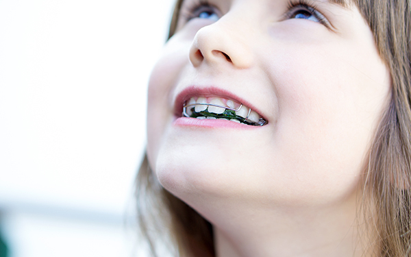 子どもの歯科矯正「費用、方法、時期どうやって選ぶ？」ママたちの体験談