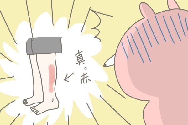 火にかけていたフライパンがない！ おんぶで料理中に何が起こった!?【産後太りこじらせ母日記 第8話】