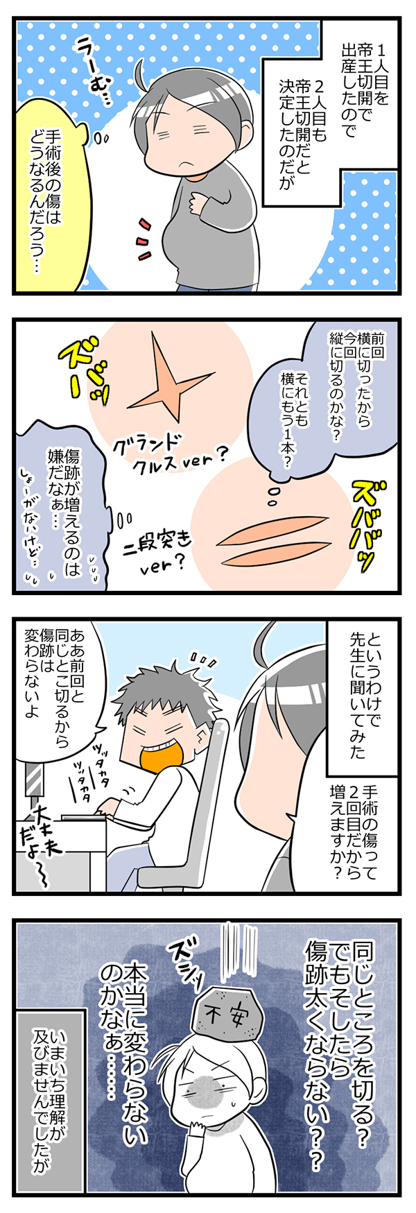 気になる帝王切開後の傷あと！ 2人目の出産後に確認すると意外な結果に【ヲタママだっていーじゃない！ 第17話】
