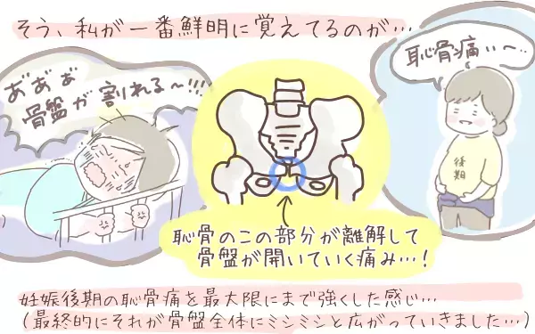 まるで体内でどんどん巨大化する鉄球…！ 強烈な恥骨痛に泣いた自然分娩【ゆるっとはなまる育児 第1話】