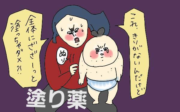 まさか水疱瘡？ 次男の体にブツブツが！ ママの判断ポイント【コソダテフルな毎日 第100話】