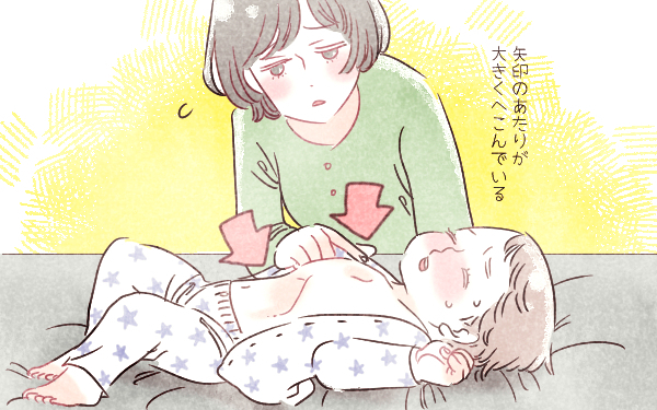 【医師監修】赤ちゃんが重症化しやすいRSウイルス感染「せき・鼻水がとまらない…」＜パパ小児科医の子ども健康事典 第11話＞