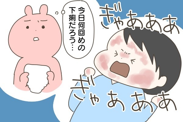 うちの子重症だったんだ…。アトピー性皮膚炎で緊急入院（前編）【産後太りこじらせ母日記 第28話】