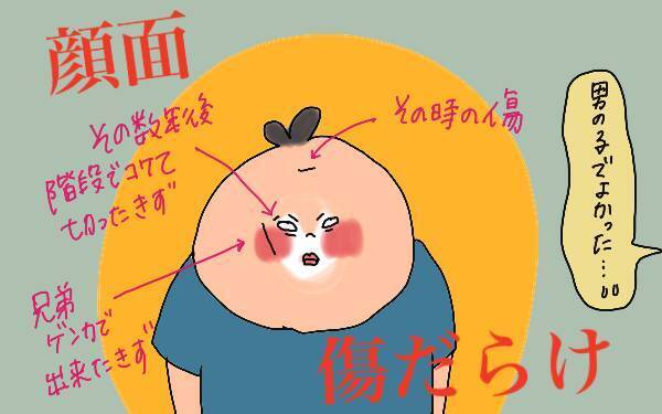 子どもが顔から地面に落ちて流血！2歳児の怪我は突然に…【コソダテフルな毎日 第116話】