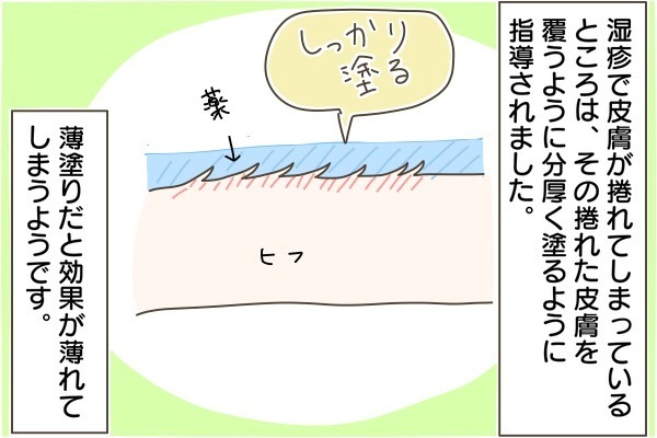 アトピー性皮膚炎で緊急入院（後編）！ 母が学んだことは【産後太りこじらせ母日記 第29話】
