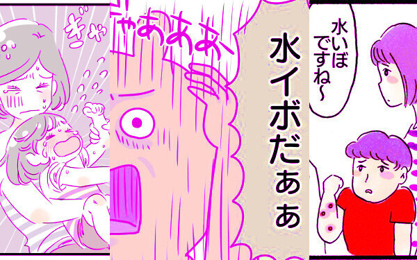 プールに入ってOK？　「水いぼ」症状、治療法、予防方法【ママが知るべき「子どもの感染症」傾向と対策 第10回】
