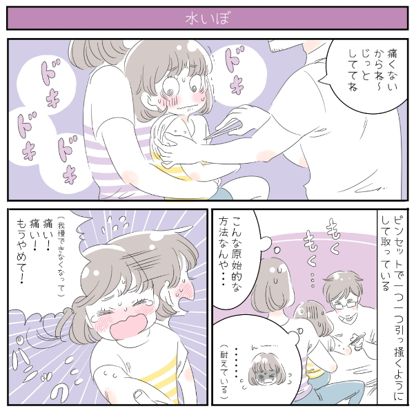  プールに入ってOK？　「水いぼ」症状、治療法、予防方法【ママが知るべき「子どもの感染症」傾向と対策 第10回】