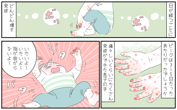 発疹、痛み、かゆみ最後まで苦しめられた…～子どもの手足口病はじめて物語～【子育ては毎日がたからもの☆ 第60話】