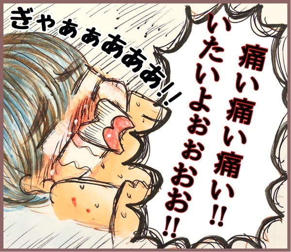 水イボは取る？ 様子見？ アトピー体質の長男に選んだのは…【メルヘン男子とPOWER PUFF BOY  第19話】