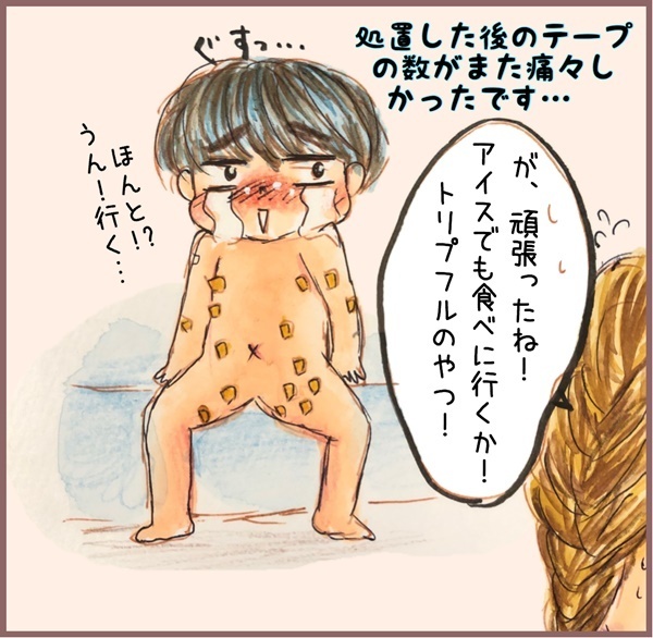 水イボは取る？ 様子見？ アトピー体質の長男に選んだのは…【メルヘン男子とPOWER PUFF BOY  第19話】