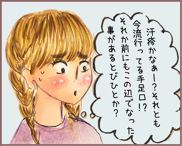 水イボは取る？ 様子見？ アトピー体質の長男に選んだのは…【メルヘン男子とPOWER PUFF BOY  第19話】