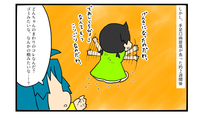 頭皮にまで発疹が！  夏休みに子どもたちが「手足口病」にかかって大変だった話【ぽこちゃんです＆どんちゃんです Vol.2】